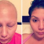 Люди, которые победили рак, в фотографиях до и после