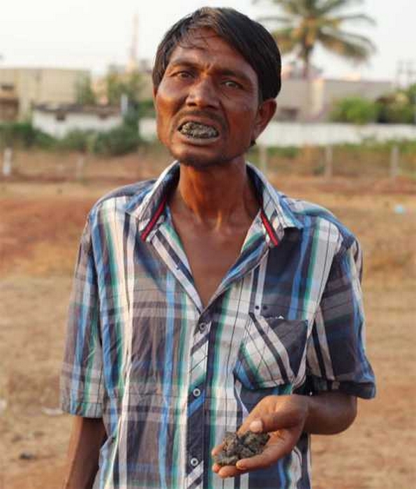 “Пожиратель кирпичей”: мужчина в Индии съел 5 тонн камней и не может объяснить зачем 28