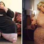14 фотографий До и После похудения. Эти люди показали свою силу воли!