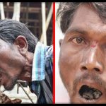 “Пожиратель кирпичей”: мужчина в Индии съел 5 тонн камней и не может объяснить зачем