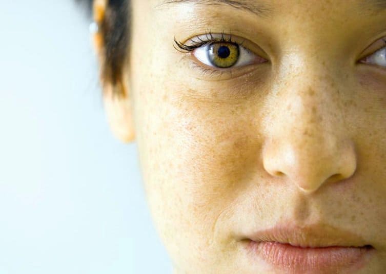 10 особенностей внешности, которые могут говорить о скрытом течении болезни 38
