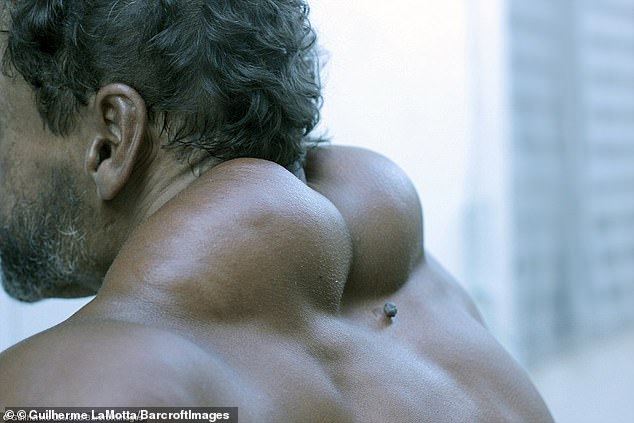 «На все ради красоты»: бразилец рискует жизнью, вводя в свои мышцы синтол 24