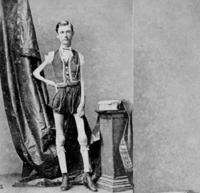 16 фотографий циркачей прошлого, от которых кровь стынет в жилах 38