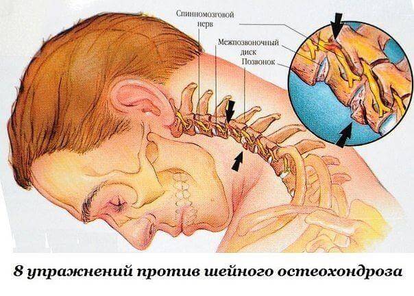 Полезные советы для борьбы с остеохондрозом.