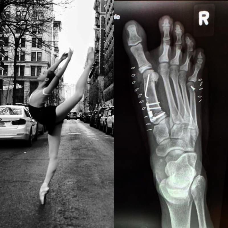 Фотографии, которые доказывают, что балерины — люди нереальной силы воли 65