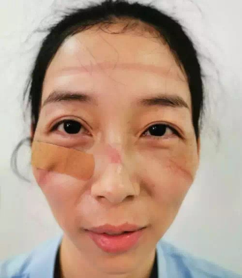 Врачи показали, как выглядят их лица после смен в больницах, где они помогают пациентам с коронавирусом 27