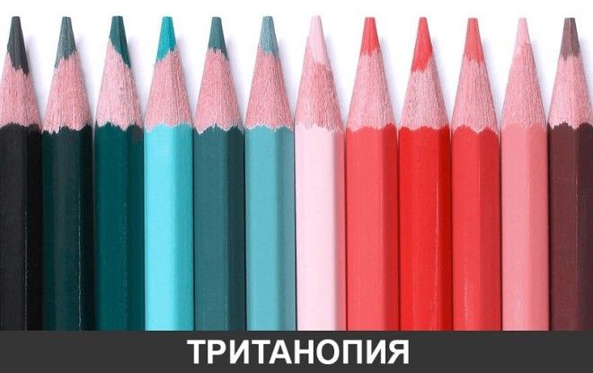 SBКак видят мир люди с разными дефектами зрения